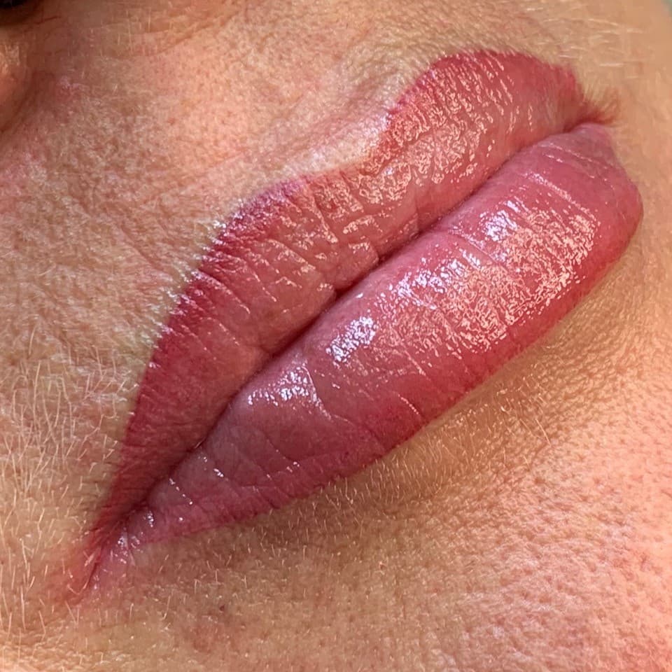 Example of lip treatment